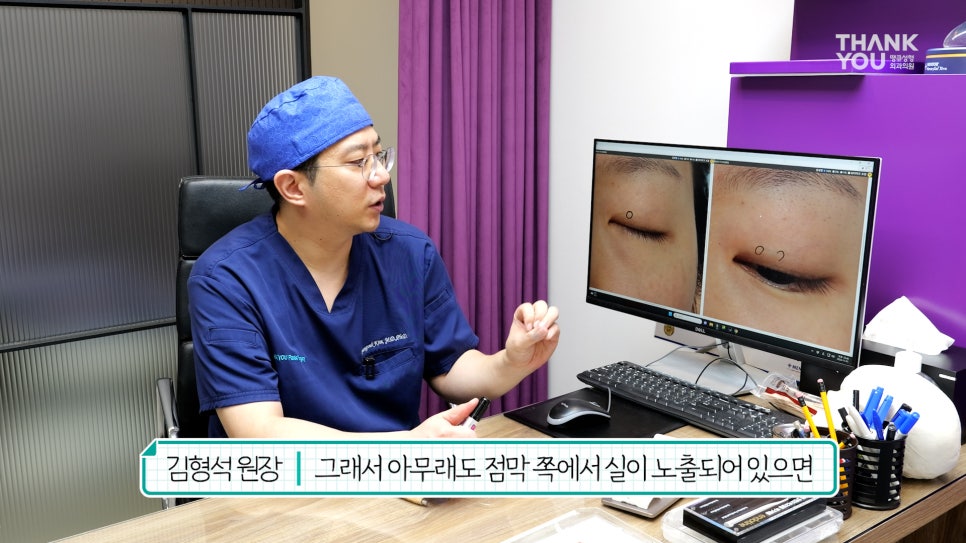 '쌍꺼풀 실 눈찌름'으로 안과? 쌍수실 제거+자연유착 라인 살리는 법 관련 이미지 18