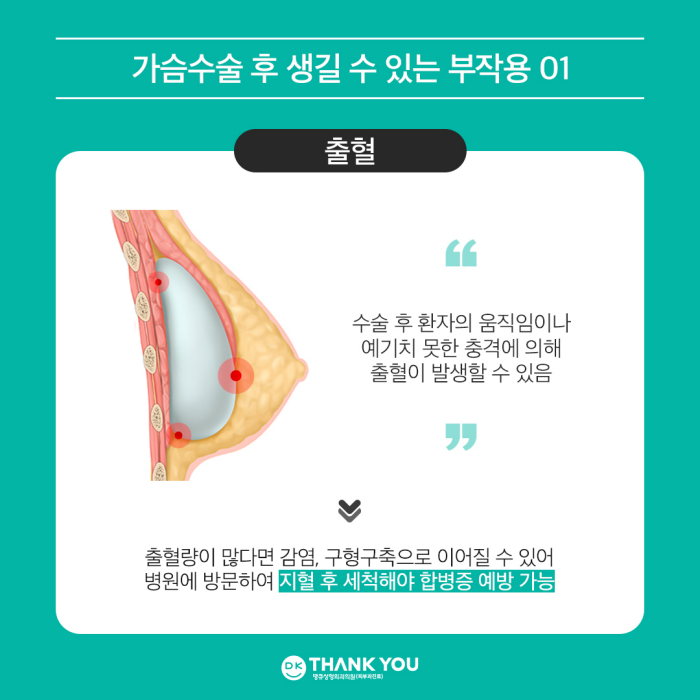 What Are the Side Effects of Breast Augmentation Surgery? image 3