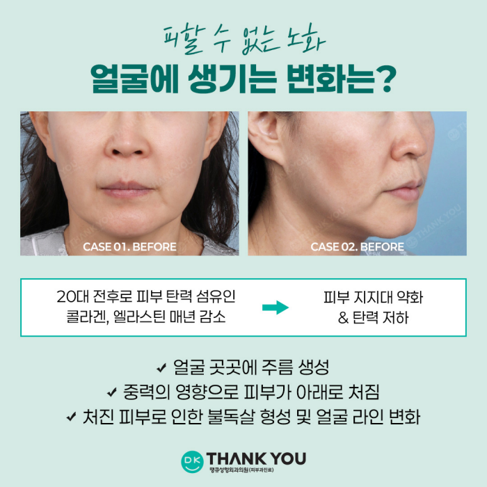 If You Want to Create a Noticeable Difference Before and After Face Thread Lifting image 2