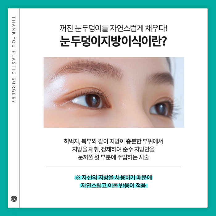 눈두덩이지방이식으로 피곤한 이미지 탈출! 생기있는 눈매 완성! 관련 이미지 4