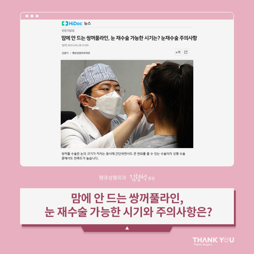 짝눈 교정, 쌍수 재수술 시기 알려드려요 관련 이미지 1