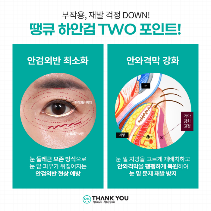 Solving Under-Eye Aging with Lower Blepharoplasty! image 8