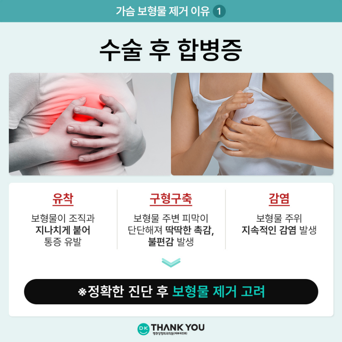 가슴보형물제거, 어떤 경우에 시행될까? 관련 이미지 2