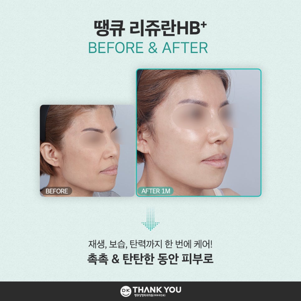 Relieve Seasonal Dryness and Fine Wrinkles at the Same Time with Rejuran HB Benefits! image 10
