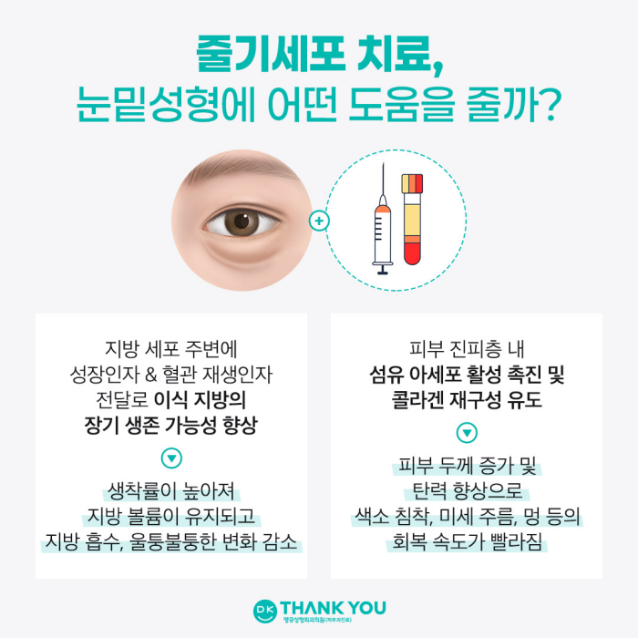 눈밑성형수술 만족도를 높이는 방법은? 관련 이미지 5