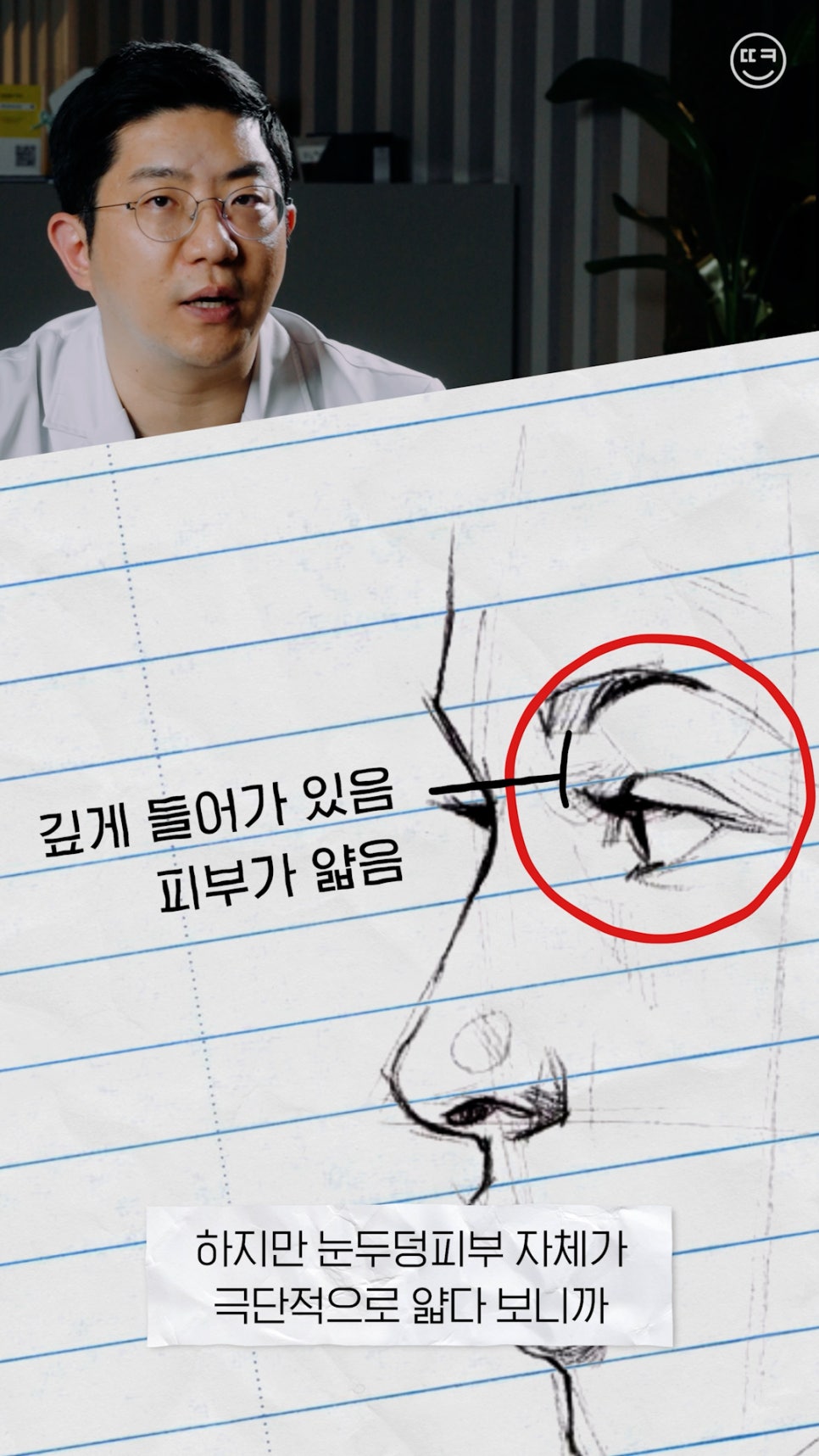 돌출눈 쌍수, 함몰눈 쌍수?! 땡큐성형외과에서 알려드려요! (땡큐썰) 관련 이미지 15