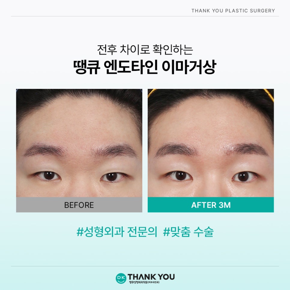 엔도타인 비용? 이마거상 시 정품 여부부터 체크!⭐️ 관련 이미지 8