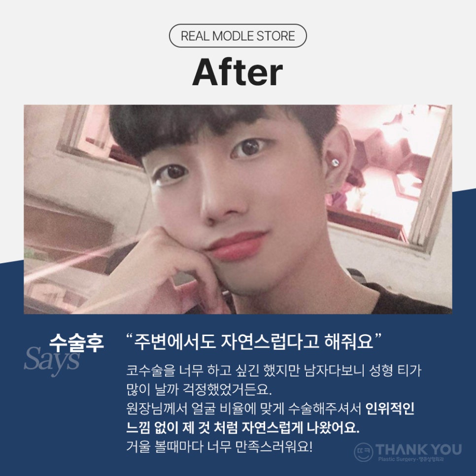 남자코성형 (휜코, 매부리코 등) 기능코성형 필요! [ft.코수술전후] 관련 이미지 22