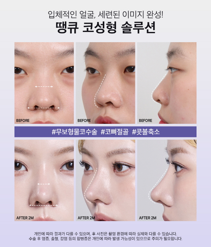 맥미걸 관련 이미지 4