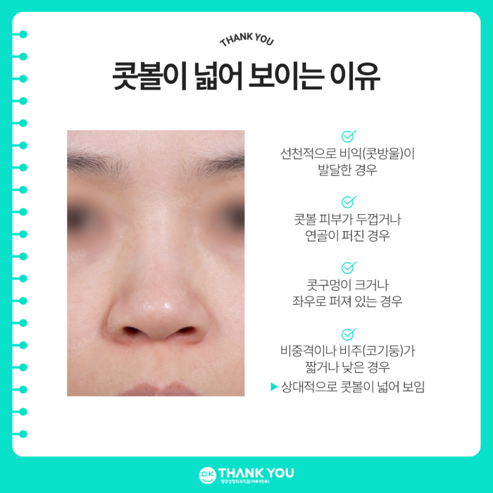 콧볼축소술 후기 좋은 땡큐에서 세련된 코 완성😉 관련 이미지 3