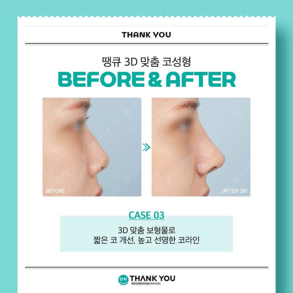 땡큐성형외과 권정우 원장, 해외 성형외과 학회서 코수술 강연 진행 (feat. 3D 맞춤 보형물) 관련 이미지 9