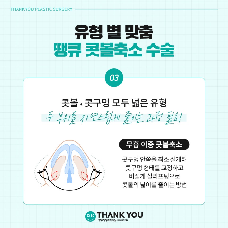 Rhinoplasty Before and After? See the Stylish Nose Created at Thank You Here! image 8
