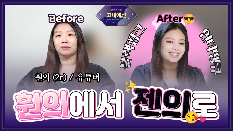 [비절개눈매교정+앞윗트임+눈밑지] 자고 일어났을 뿐인데 제니가?! 관련 이미지 1