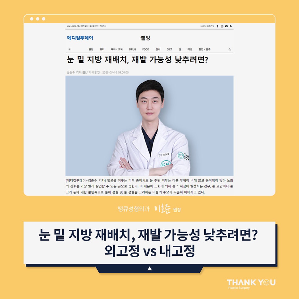 땡큐성형외과 이호준 원장님, 눈밑지방재배치 외고정vs내고정 차이점 관련 이미지 1