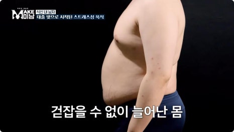 맥미남 식신내남자, 남자다이어트 2달동안 30kg감량 성공 (땡큐 지방흡입/여유증) 관련 이미지 3