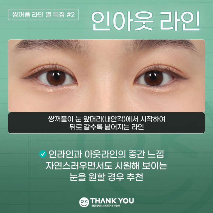 Double-Eyelid Surgery Line: Which One Suits Me Best? image 4
