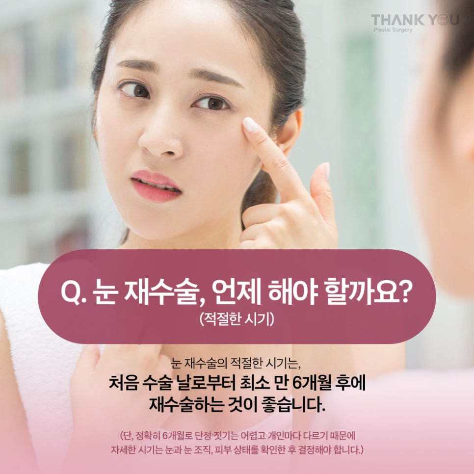 짝눈 교정, 쌍수 재수술 시기 알려드려요 관련 이미지 10