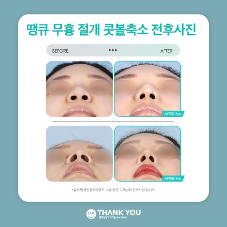 Successful Sophisticated Image Transformation with the Thank You Alar Reduction Event! image 7