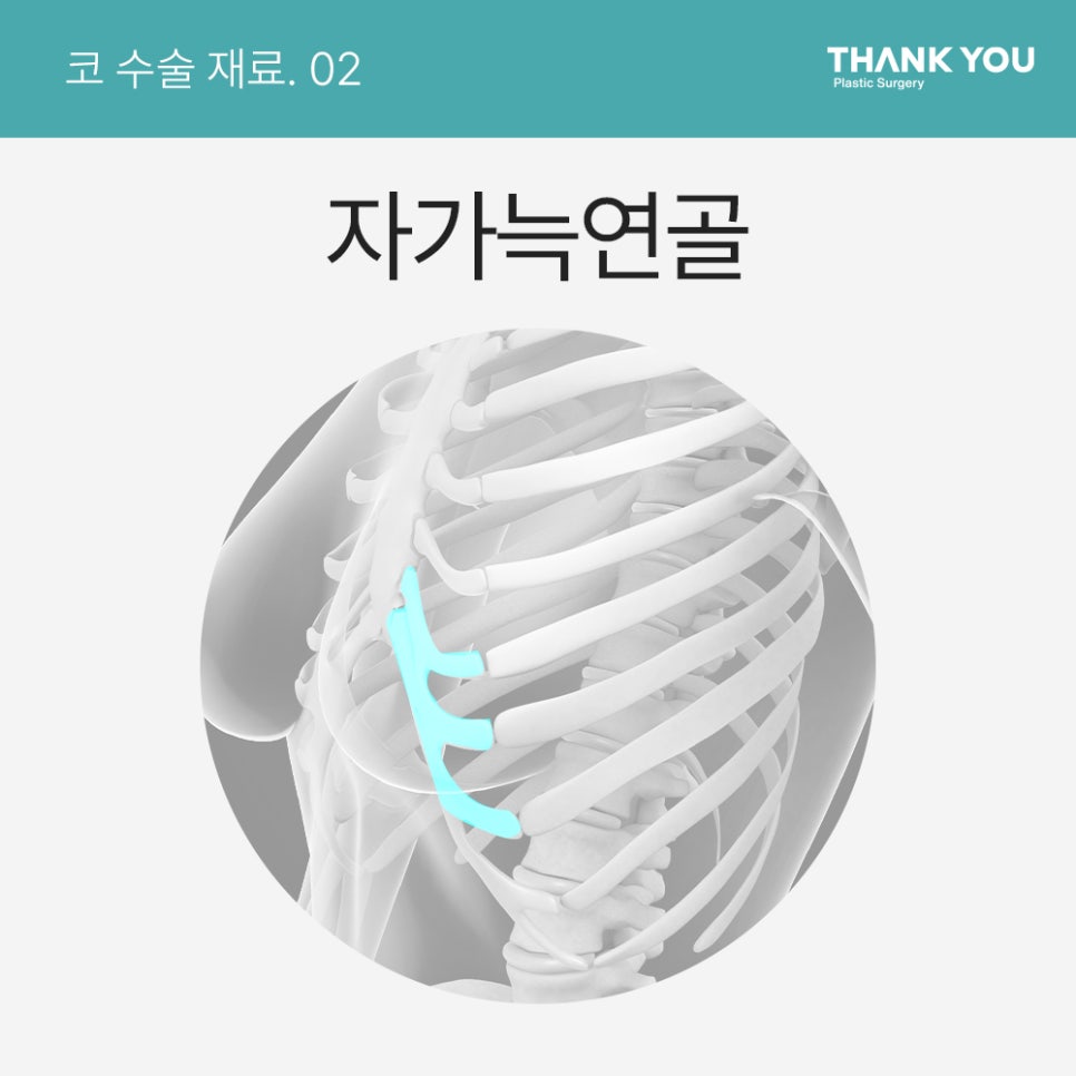 자가늑연골? 기증늑연골? 코성형수술 재료의 끝판왕? 관련 이미지 2