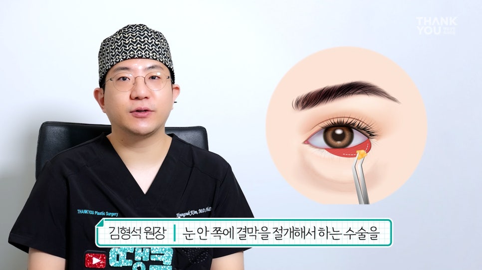 연예인 눈밑지방재배치?경결막과 눈물고랑이란? 관련 이미지 4