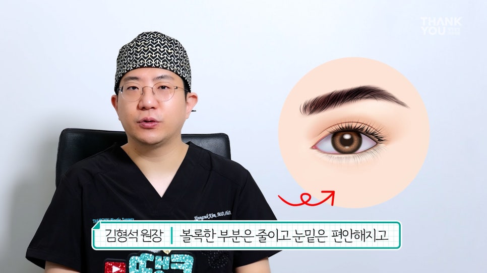 연예인 눈밑지방재배치?경결막과 눈물고랑이란? 관련 이미지 14