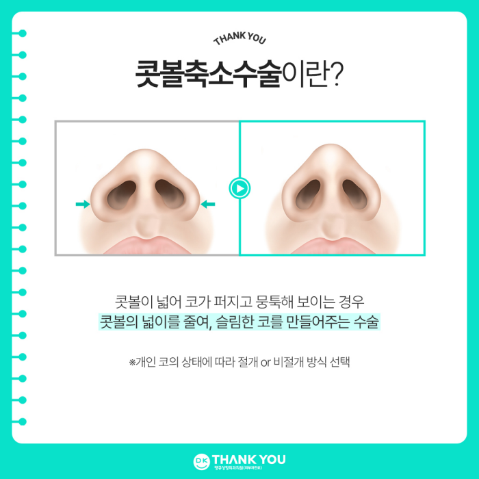 콧볼축소술 후기 좋은 땡큐에서 세련된 코 완성😉 관련 이미지 2