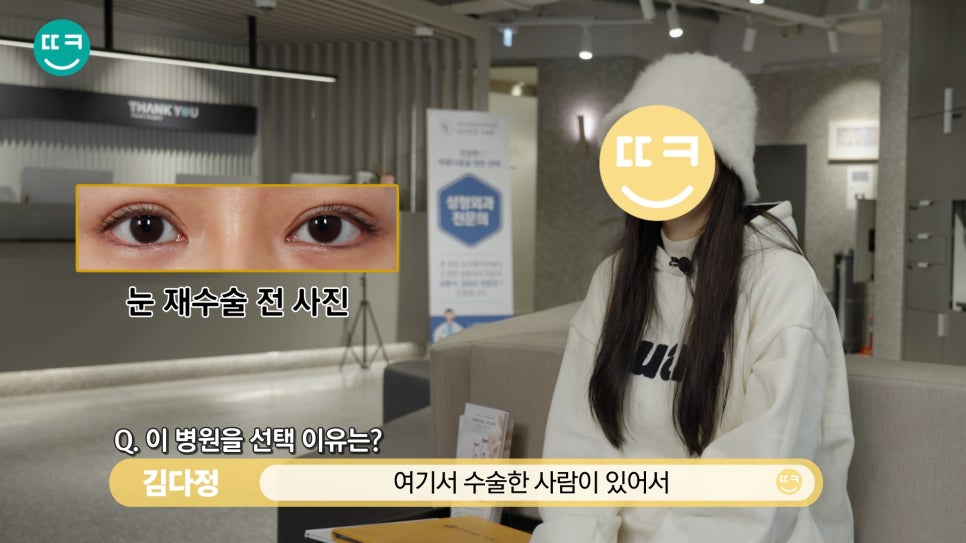 짝눈 쌍수 재수술, 짝짝이 라인과 비대칭쌍꺼풀 대칭 맞추기 관련 이미지 7