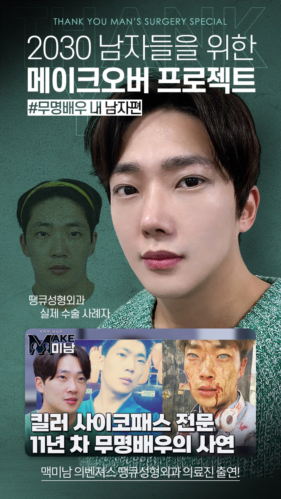 남자코성형 (휜코, 매부리코 등) 기능코성형 필요! [ft.코수술전후] 관련 이미지 25