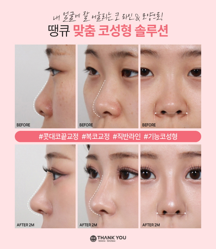 맥미걸 관련 이미지 4