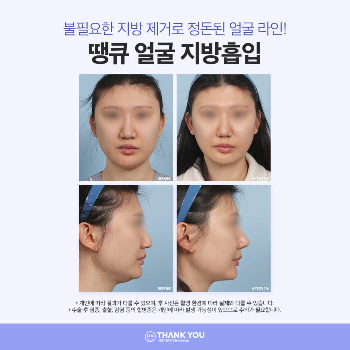 Create a Harmonious Face with Improved Face Line! Complete a Line That Suits Your Features⭐ image 4