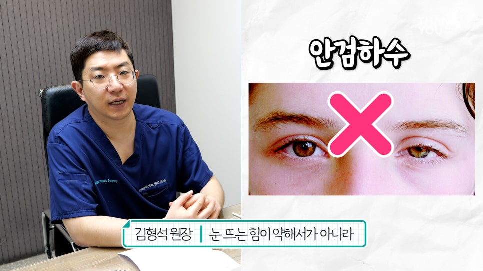 눈재수술 할 때 이마거상 추천하는 이유는? (눈썹올림술 전후) 관련 이미지 12