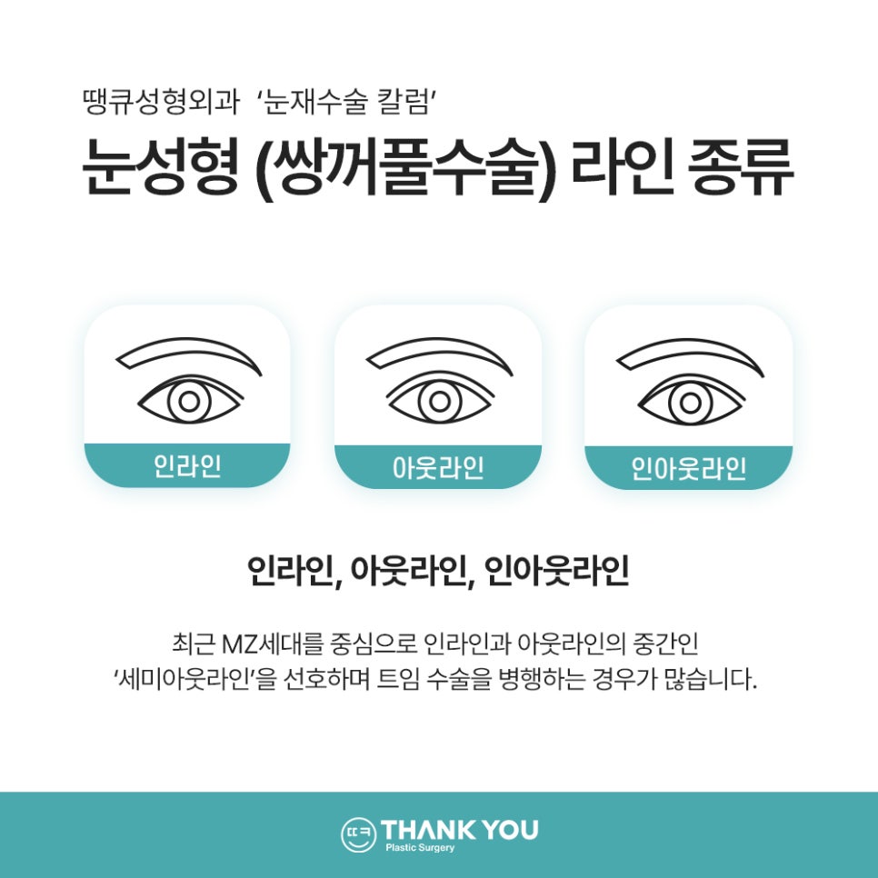 눈재수술 실패하지 않으려면? 눈 재수술유형&전후 체크 관련 이미지 3