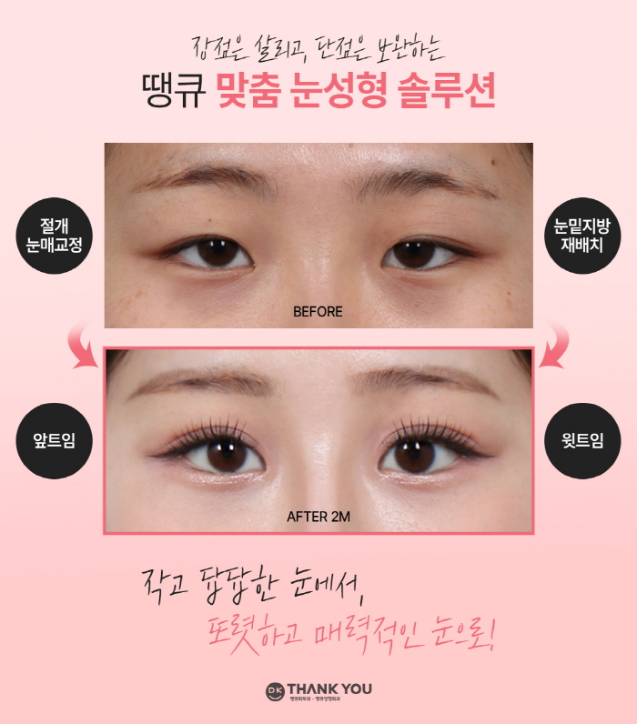 맥미걸 관련 이미지 8