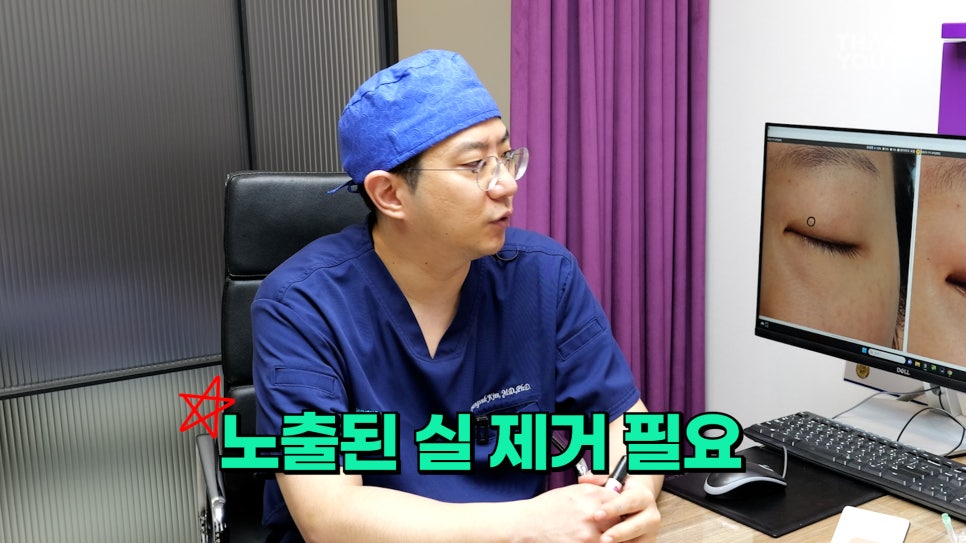 '쌍꺼풀 실 눈찌름'으로 안과? 쌍수실 제거+자연유착 라인 살리는 법 관련 이미지 20