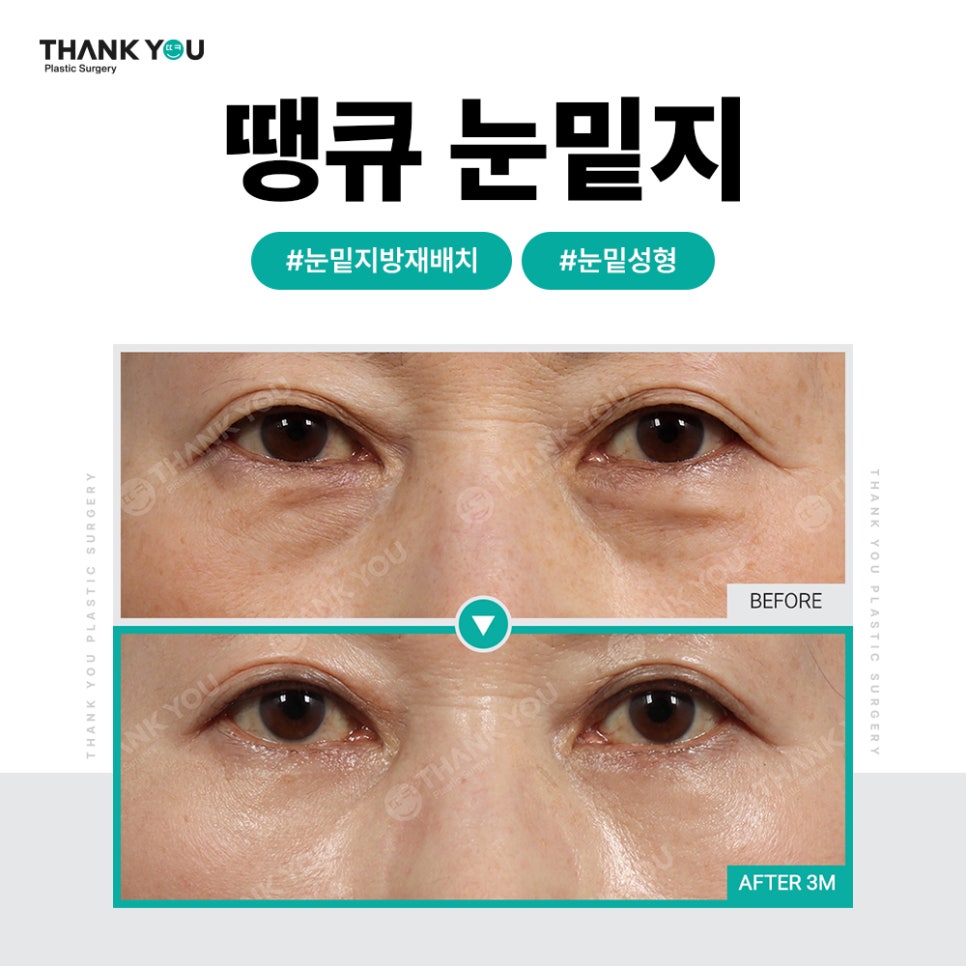 화려한 눈 가능?! 인아웃라인 김세정 쌍꺼풀처럼 관련 이미지 28