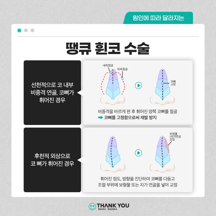 기능코수술병원에서 콧 속 불편함, 외적 스트레스 동시 해소! 관련 이미지 5