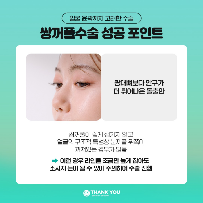 쌍꺼풀수술병원에서 알려주는 눈성형 성공 포인트! 관련 이미지 4