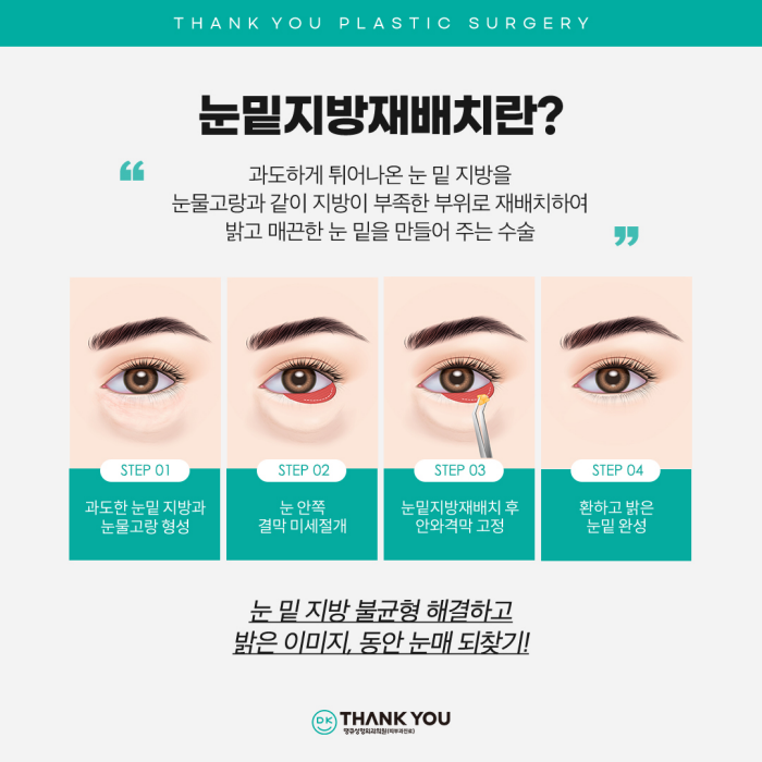 Recommended Under-Eye Fat Repositioning! Transform Your Look to Be Brighter and More Vibrant! image 4