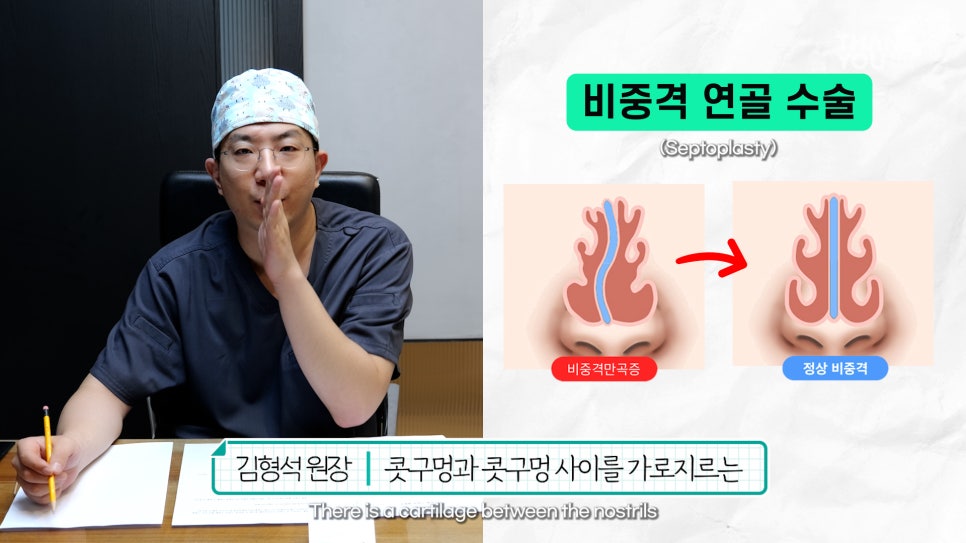 2분만에 막힌 코 뻥 뚫어주는 코블레이션 [ft.비염코성형 전후] 관련 이미지 7