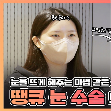 엄빠 몰래 이마거상 성공! (뒤밑트임 후기) 관련 이미지 1