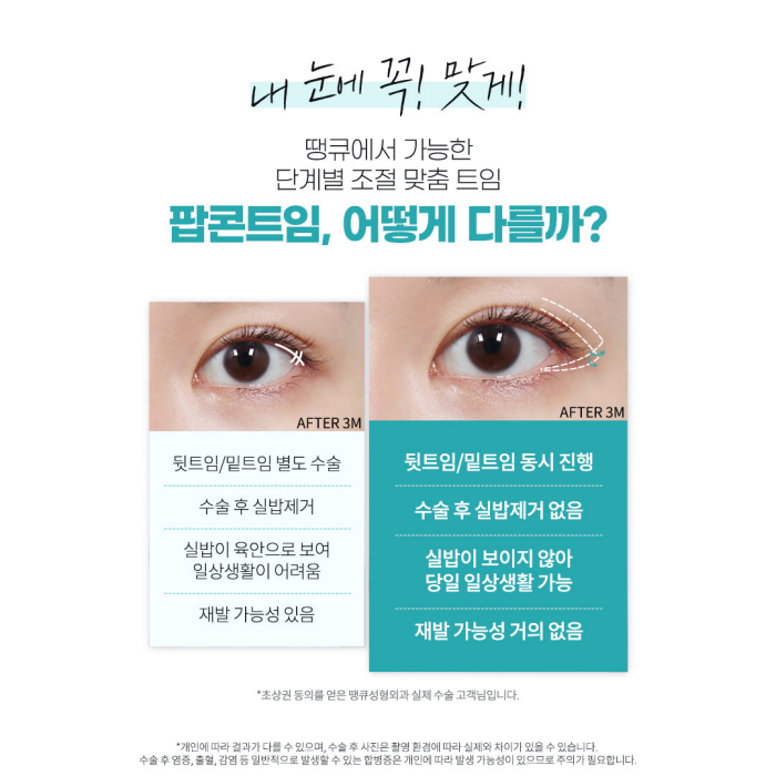 Thank You Plastic Surgery Popcorn Canthoplasty Event✨ image 3