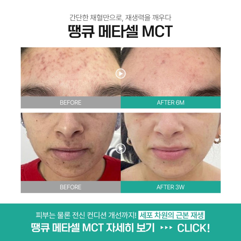 땡큐성형외과 권정우 원장 관련 이미지 6