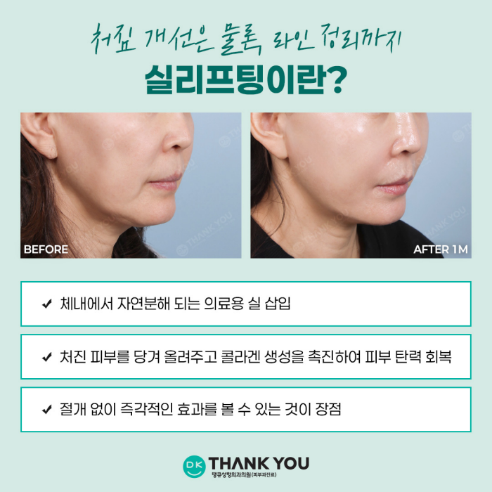If You Want to Create a Noticeable Difference Before and After Face Thread Lifting image 3