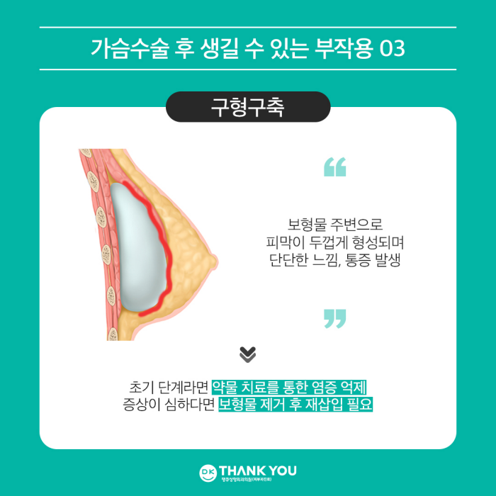 What Are the Side Effects of Breast Augmentation Surgery? image 5
