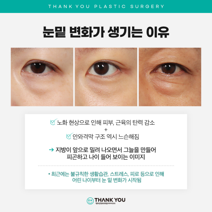 Recommended Under-Eye Fat Repositioning! Transform Your Look to Be Brighter and More Vibrant! image 3