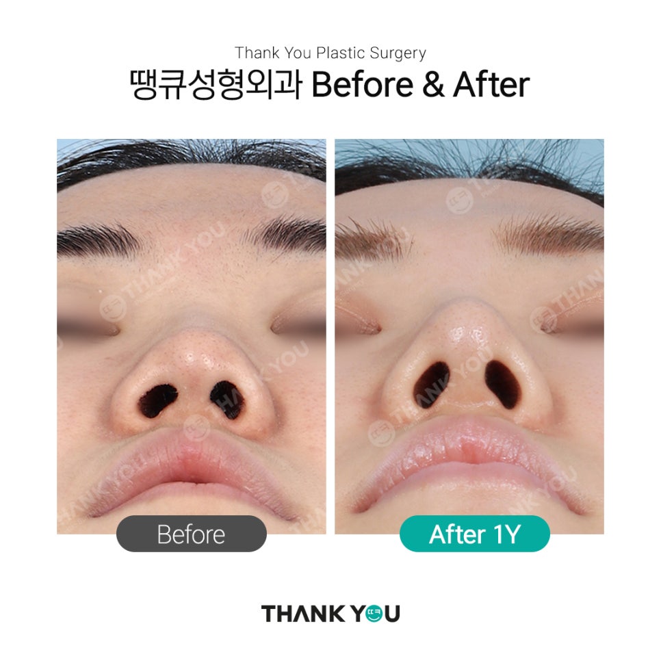 자연스러운 코?직반라인체크+코 비주란? 관련 이미지 3