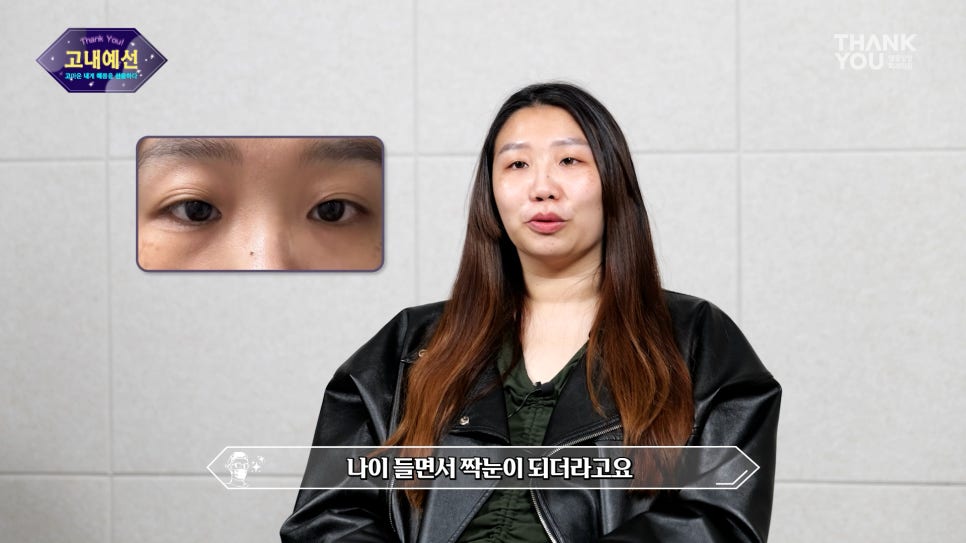 [비절개눈매교정+앞윗트임+눈밑지] 자고 일어났을 뿐인데 제니가?! 관련 이미지 9