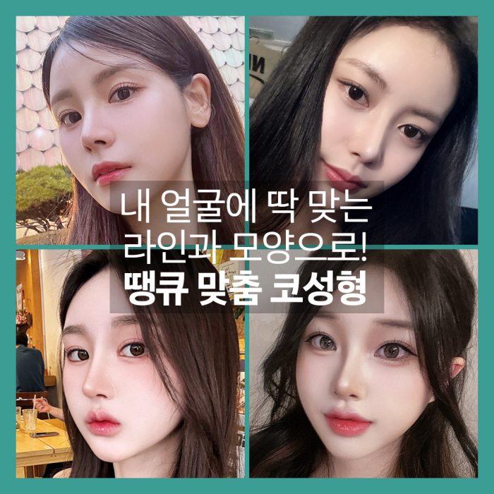 무보형물코성형 재료에 따른 특징을 알아보자! 관련 이미지 9