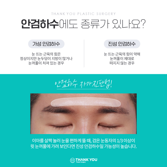 기능눈성형 근본적인 원인을 개선해야 해요! 관련 이미지 7