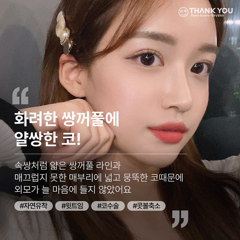눈코성형 같이 하고싶다면? (자연유착 윗트임+콧불축소) 관련 이미지 1